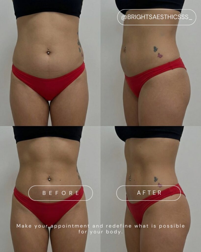 before after skinology