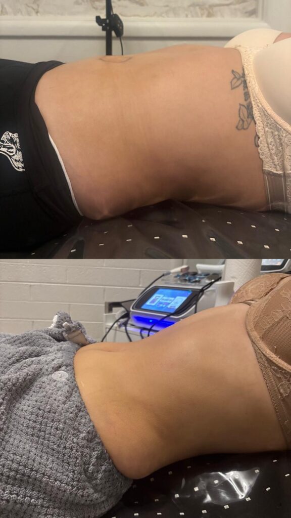 before after skinology
