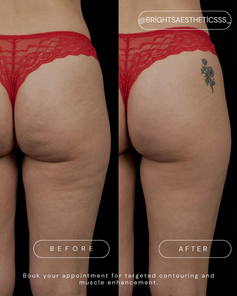 before after skinology