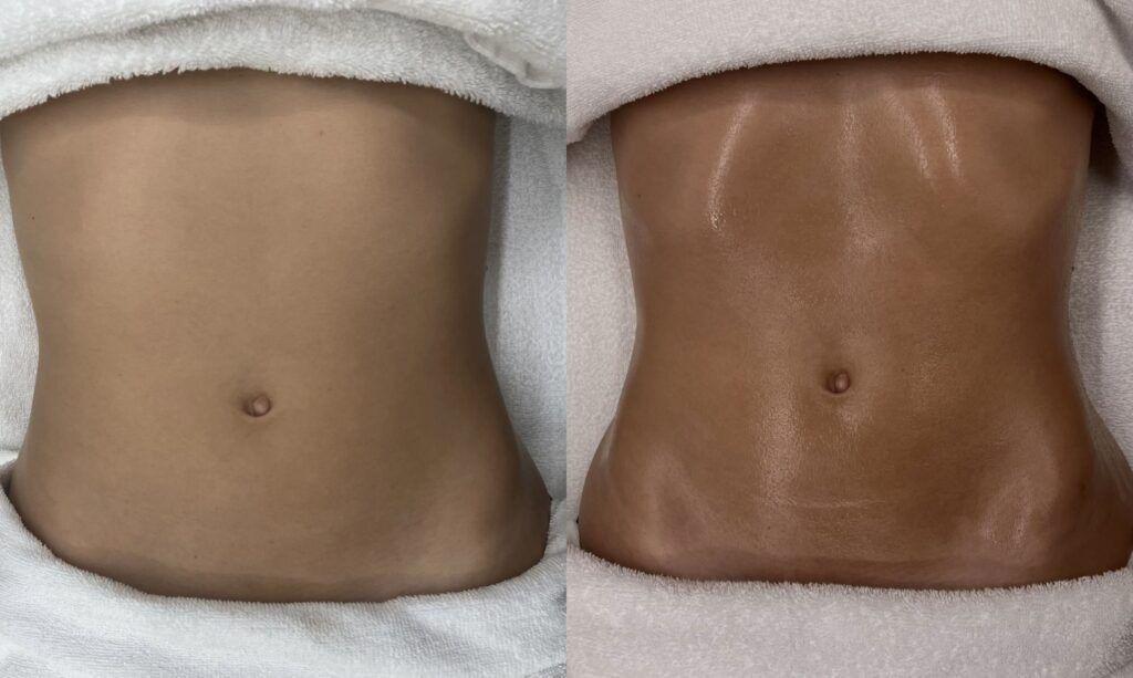before after skinology