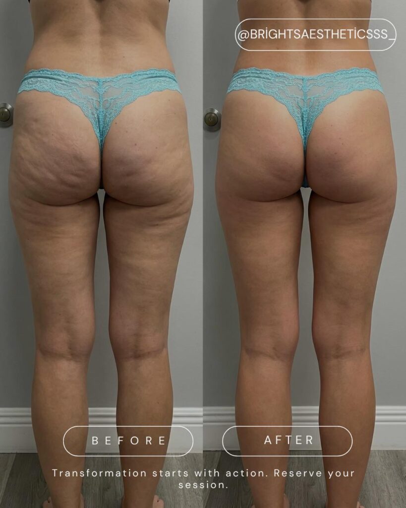 before after skinology