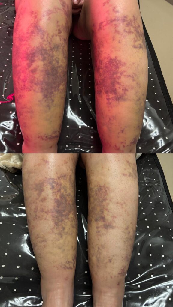 before after skinology